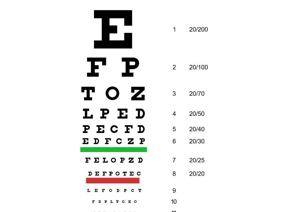 what is visual acuity