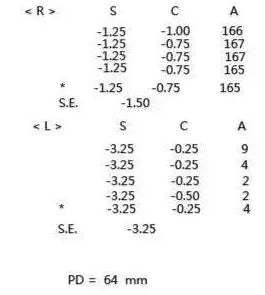 How to read the myopia prescription?